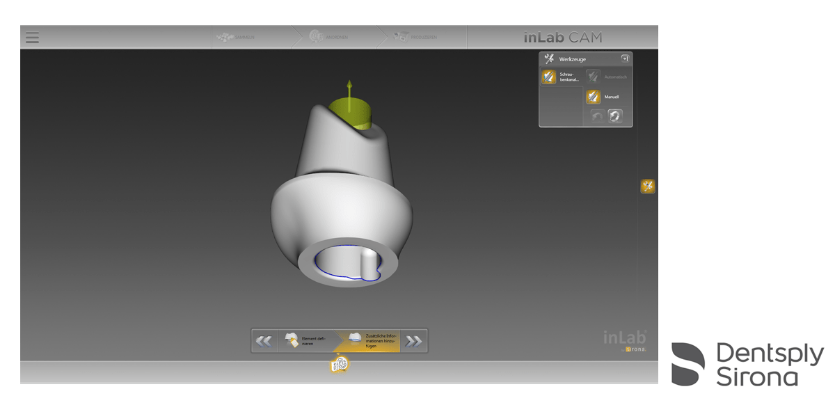 Update inLab CAM SW 16.0 mit mehr Funktionsumfang