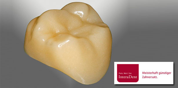 Neu: Die Peracam-Krone!