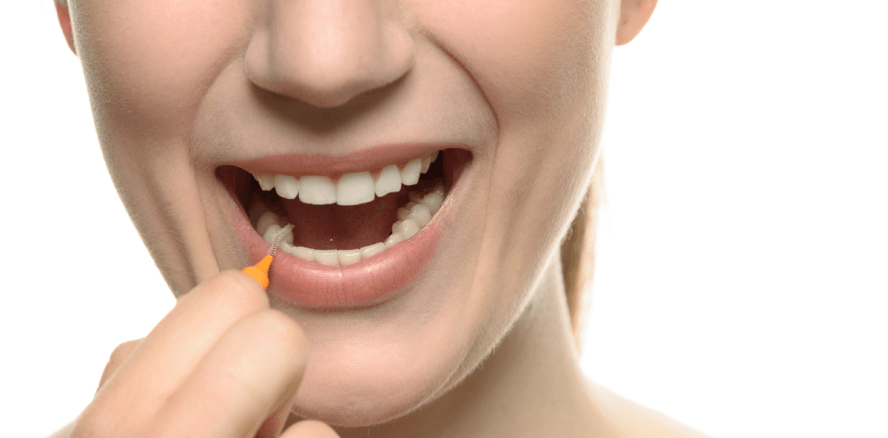 Bei Interdentalbürsten kommt es auf die richtige Größe an