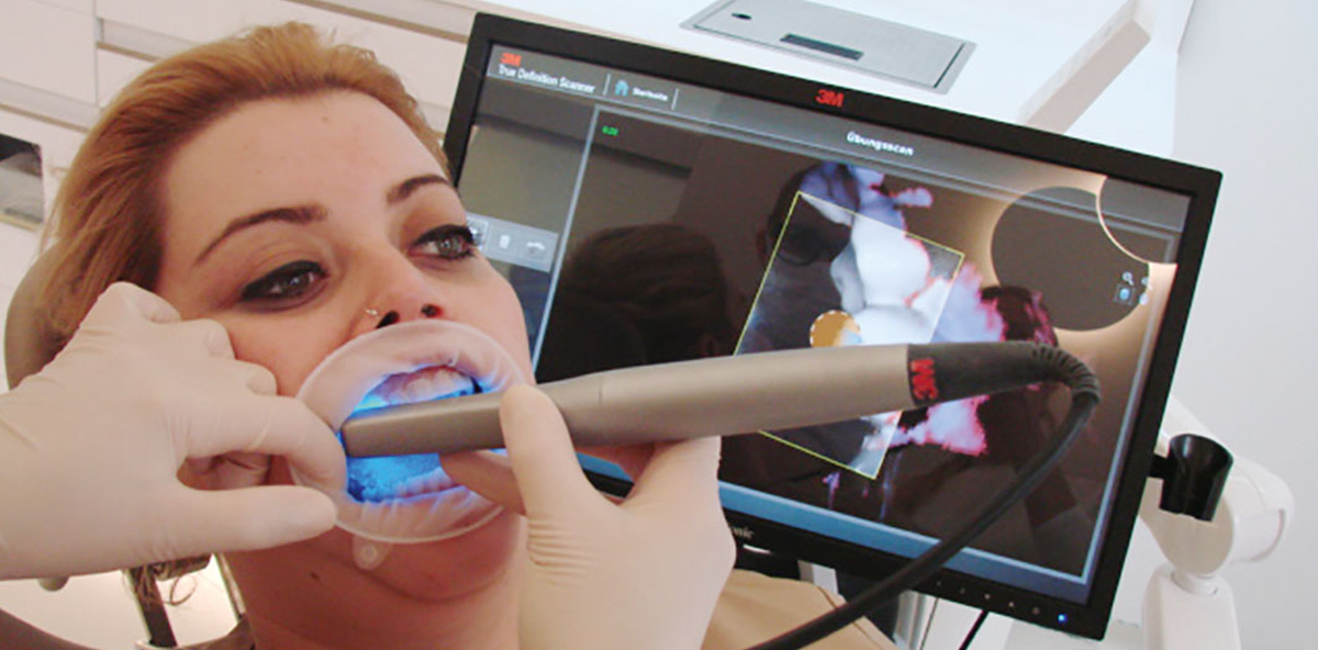 Intraoralscanner und digitalisierter Workflow in der KFO