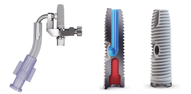 Markteinführung des Sinsusliftsystems iRaise