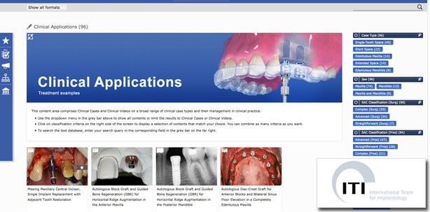 „Das Schweizer Taschenmesser im E-Learning der dentalen Implantologie“