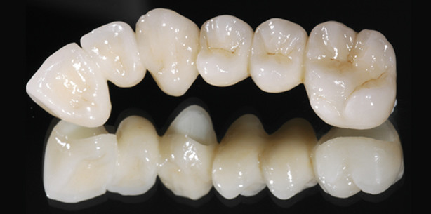 Dentale Materialien im Wandel