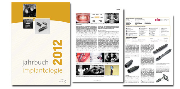 Neuerscheinung: Jahrbuch "Implantologie 2012"