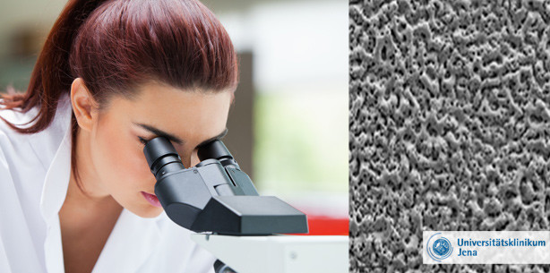 Neue Oberfläche lässt Implantate fester einwachsen