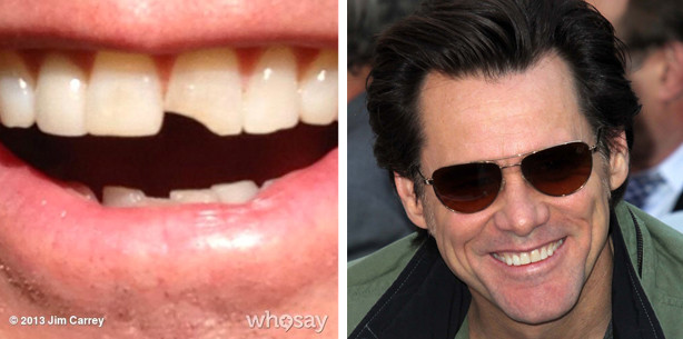 Hollywoods bekannteste Zahnlücke ist zurück