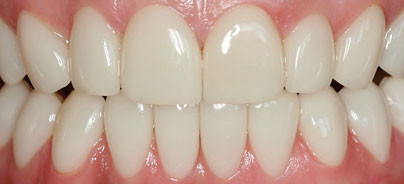 Therapien in der kosmetisch-ästhetischen Zahnheilkunde nach dem Kaiserswerther Konzept