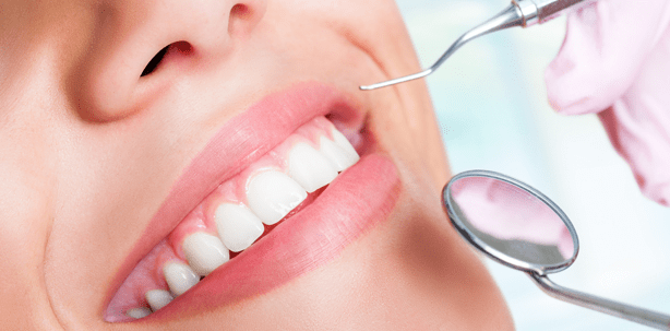 Erweiterte Kariesdiagnostikverfahren in GKV und PKV