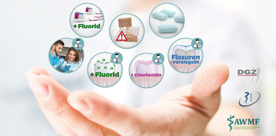 Was Sie wissen müssen: Erste Leitlinie zur Kariesprophylaxe vorgelegt