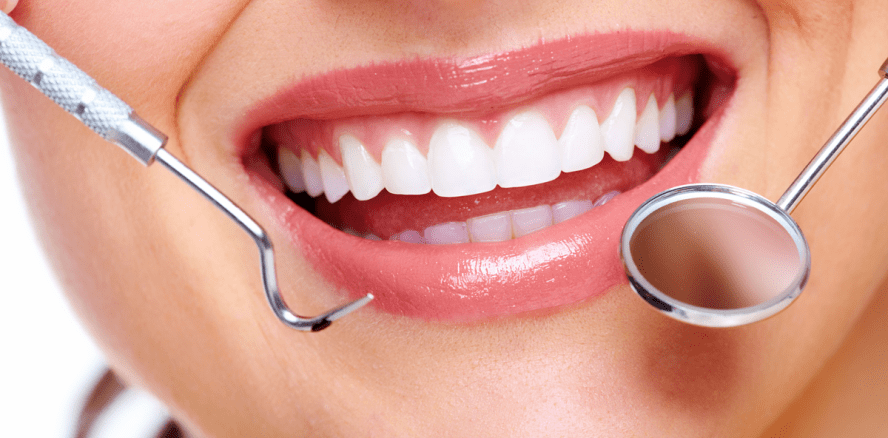 Weiße Flecken auf den Zähnen sind Vorboten für Karies