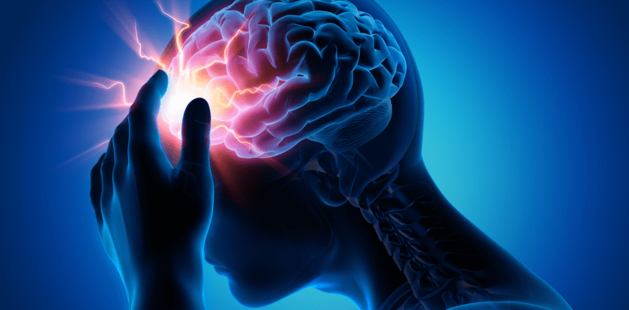 Karieserreger können Hirnblutungen verursachen