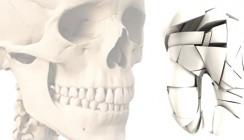 Karies schädigte schon vor 15.000 Jahren Zähne