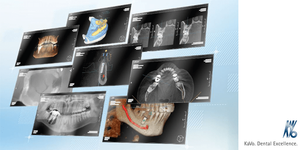 DVT und Co. Live – Indikationen für die 3. Dimension