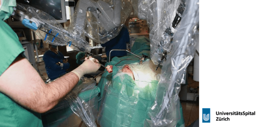 Erste totale Kehlkopfentfernung mit dem Da-Vinci-Roboter
