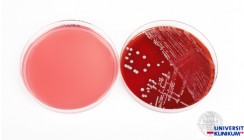 Protein mit antibakterieller Wirkung entdeckt