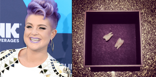 Goldiges Präsent: Kelly Osbourne verschenkt ihre Zähne