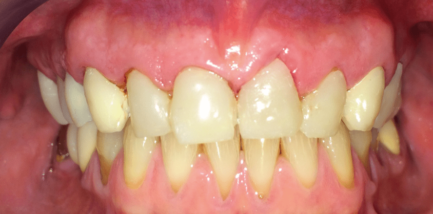 Modernste Keramik und Ästhetik – alles andere als ein Selbstläufer!