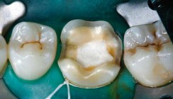 Reduzierte Mindestschichtstärken