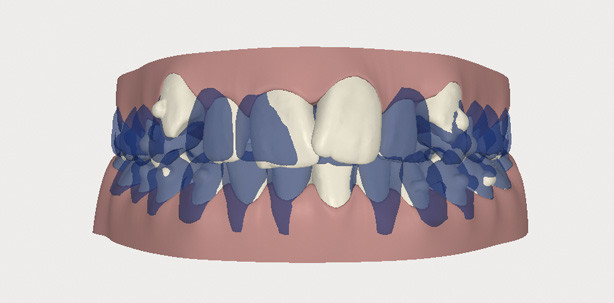 Optimierung dentofazialer Ästhetik