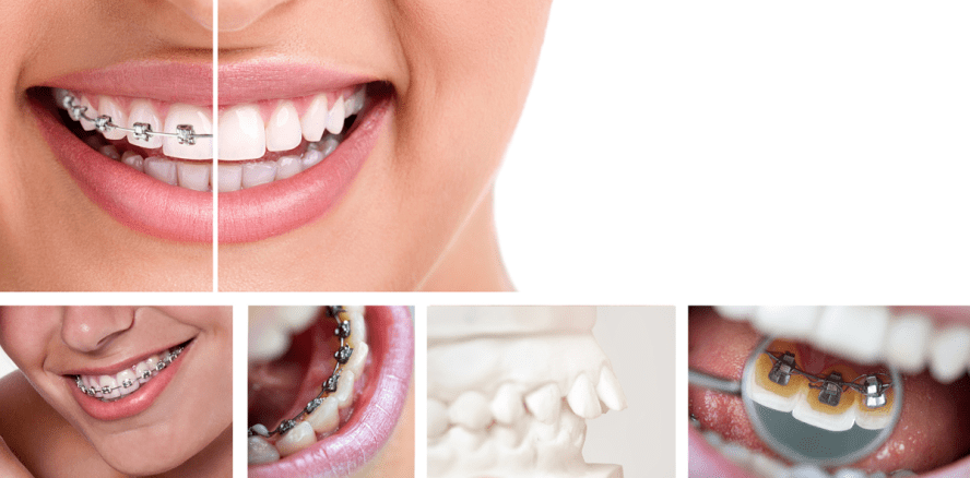 Ein Muss im kieferorthopädischen Fortbildungskalender