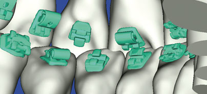 Hightech-KFO höchster Präzision (2)