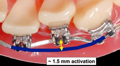 Den richtigen Draht wählen