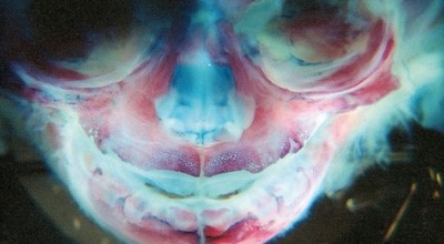 Die Entwicklung der Maxilla