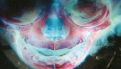 Die Entwicklung der Maxilla