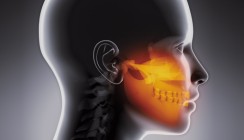 Platzmanagement und skelettale Verankerung in der Kieferorthopädie