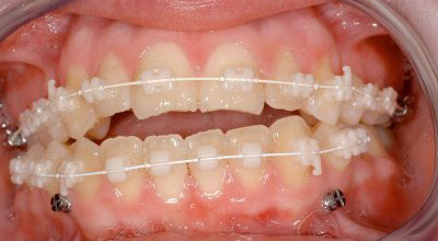 Klinische Beispiele - Teil 1