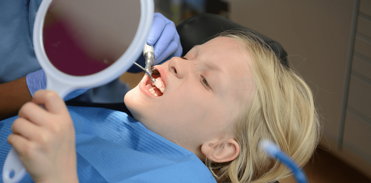 UK: Bei mehr als 128.000 Kindern müssen Zähne extrahiert werden