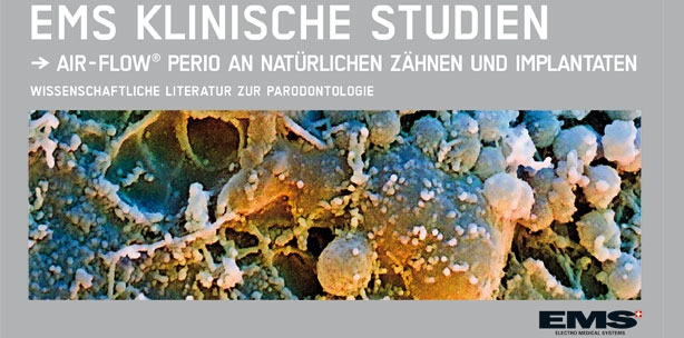EMS Air-Flow Perio erfolgreich in klinischen Studien getestet