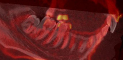 articleImage