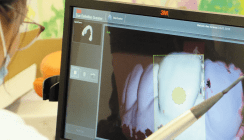 Einsatzspektrum eines Intraoralscanners