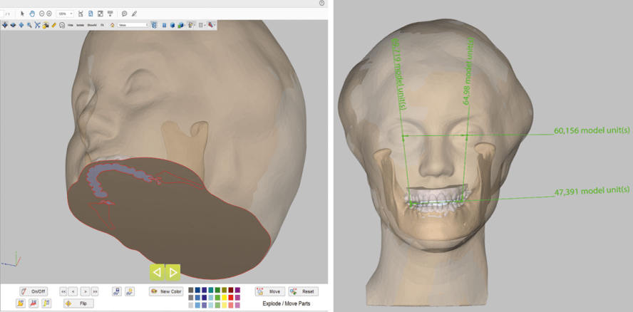Neue Dimension kieferorthopädischer Diagnose und Planung