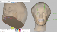 Neue Dimension kieferorthopädischer Diagnose und Planung