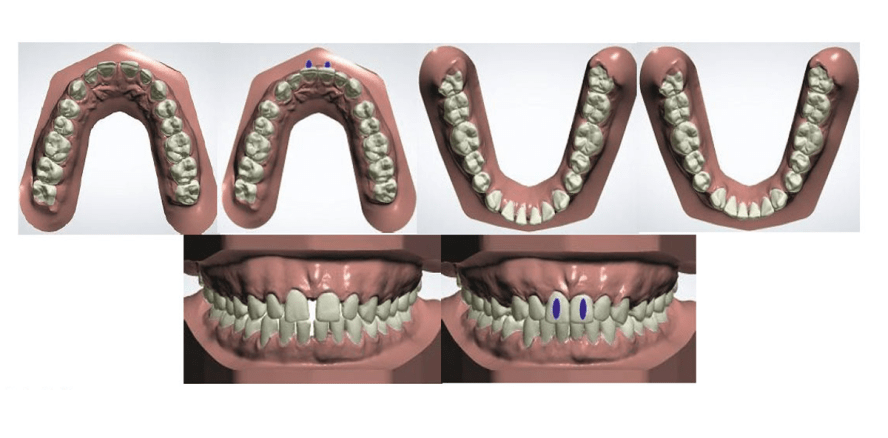 Effiziente und wirtschaftliche Behandlungsmöglichkeit