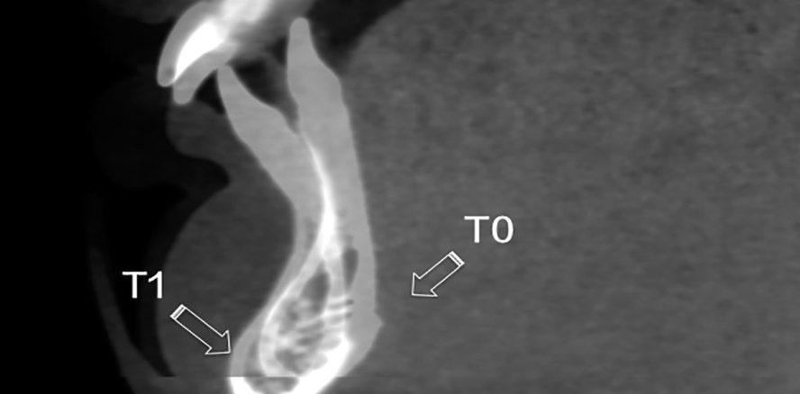 Herbst – was haben wir gelernt?