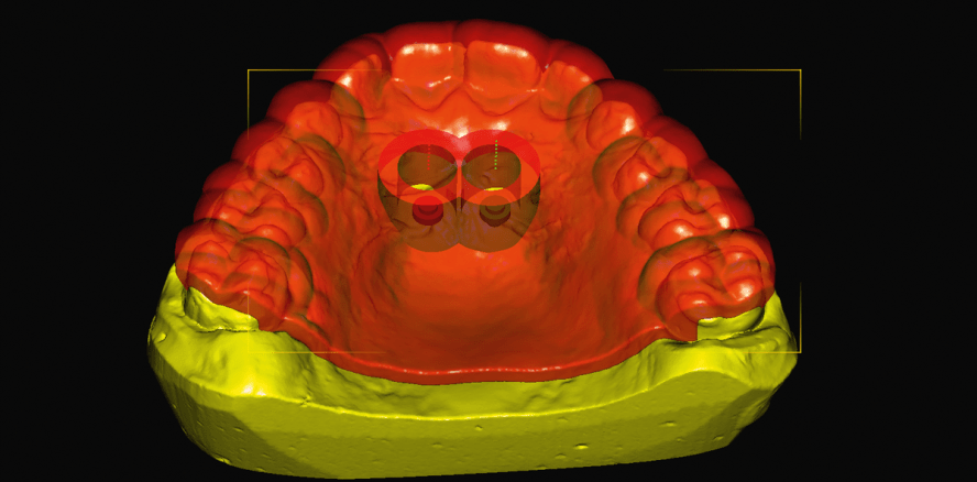 Die EASY DRIVER-Methode