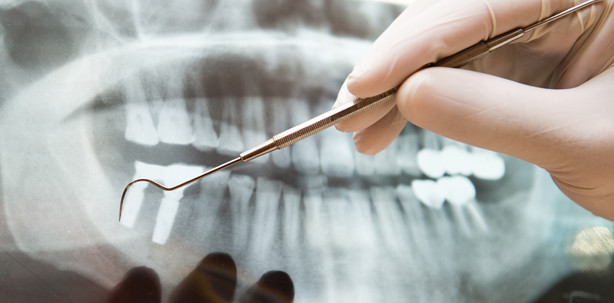 Biomarker zur Steuerung von Knochenkrankheiten
