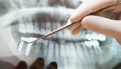 Biomarker zur Steuerung von Knochenkrankheiten