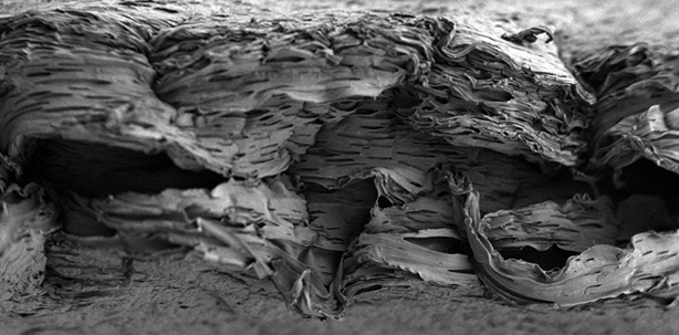 Knochenregeneration: Timing ist alles!