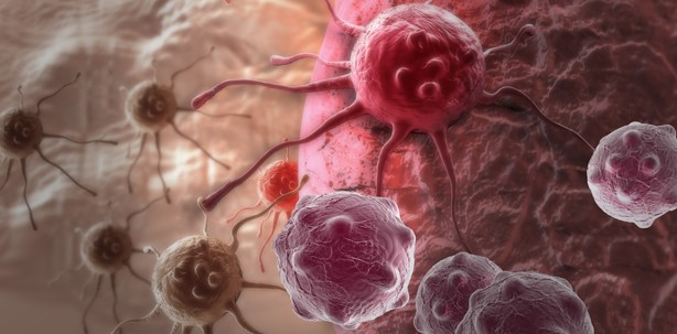 Charakteristische Mutation für Knochentumoren identifiziert