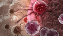 Charakteristische Mutation für Knochentumoren identifiziert