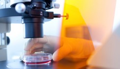Neue Osteoporose-Therapie setzt bei Knochenbiologie an