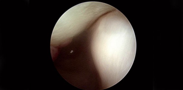 Kiefergelenkchirurgie