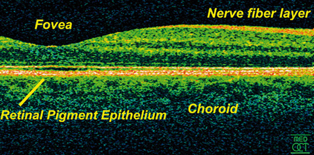 Optische Kohärenztomografie – kurz und bündig