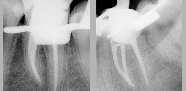 Hochwertige Endodontie – in den Praxisalltag integriert