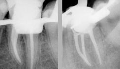Hochwertige Endodontie – in den Praxisalltag integriert