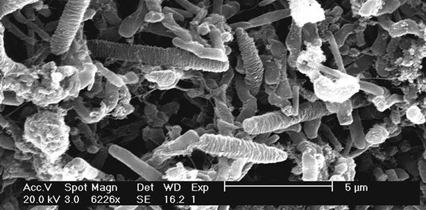 Parodontitis und die bakterielle Kommunikation im Biofilm